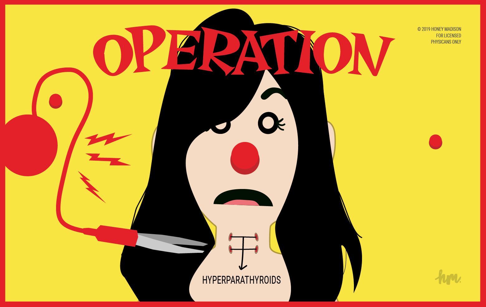 Illustration of a female version of the Operation game with hyperparathyroids identified in the neck.